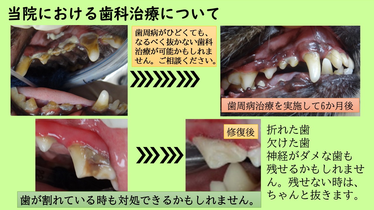 歯科処置の紹介