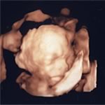 �SD�����g